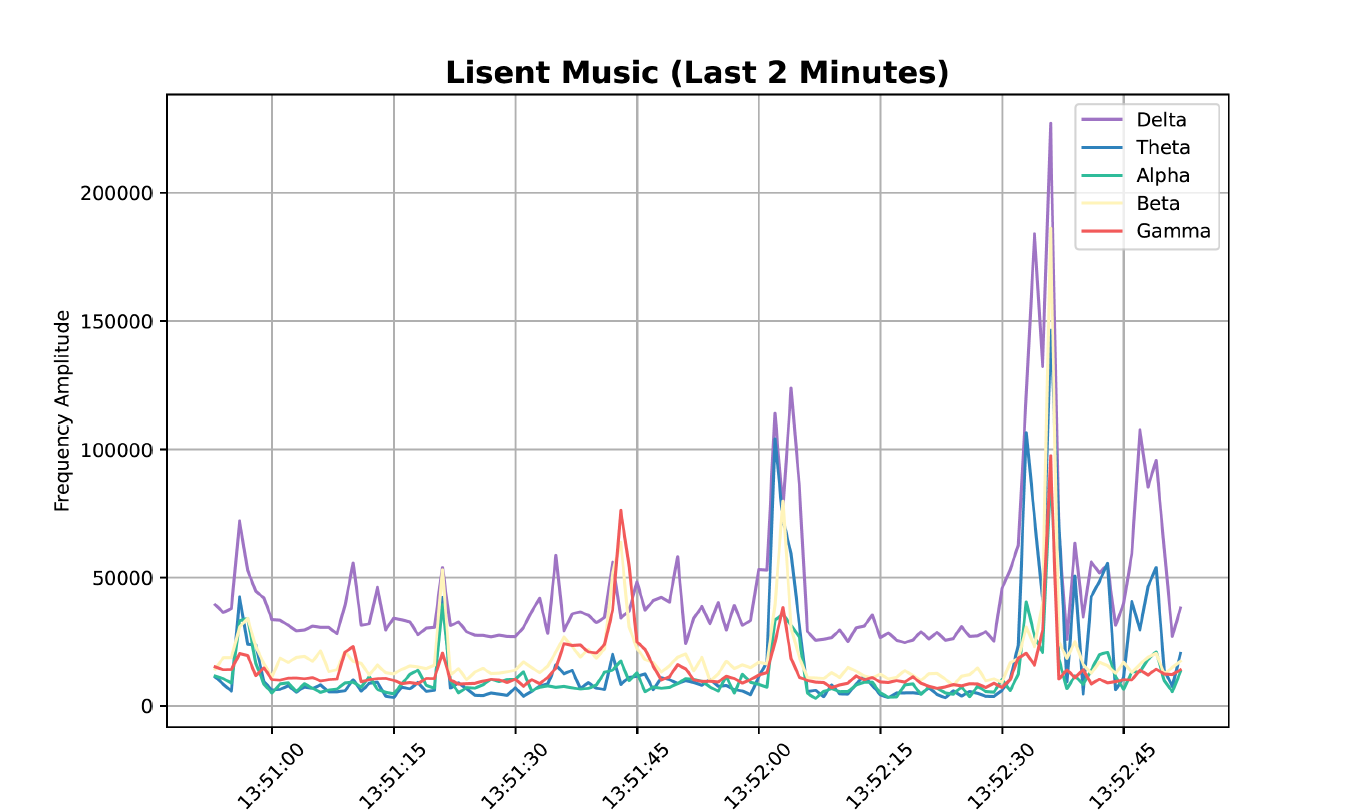 EEG Signal Processing